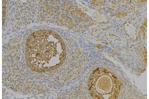 ABIN6277340 at 1/100 staining Human uterus tissue by IHC-P. (PGC antibody  (Internal Region))