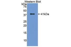 Western Blotting (WB) image for anti-Tryptase alpha/beta 1 (TPSAB1) (AA 161-262) antibody (ABIN1174171) (TPSAB1 antibody  (AA 161-262))