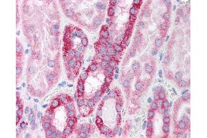 Immunohistochemistry (IHC) image for anti-Polymerase (RNA) II (DNA Directed) Polypeptide B, 140kDa (POLR2B) (AA 805-854) antibody (ABIN6736747)