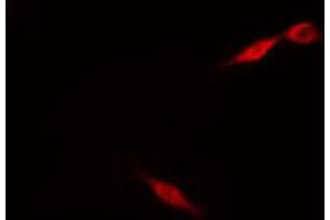 ABIN6274214 staining HeLa cells by IF/ICC.