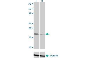 Western blot analysis of TOMM22 over-expressed 293 cell line, cotransfected with TOMM22 Validated Chimera RNAi (Lane 2) or non-transfected control (Lane 1).