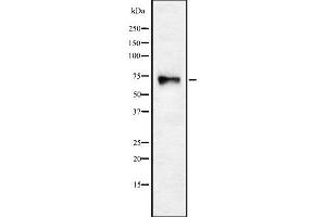 Western blot analysis of CHRNA4 using HuvEc whole cell lysates (CHRNA4 antibody  (N-Term))