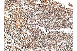 The image on the left is immunohistochemistry of paraffin-embedded Human tonsil tissue using ABIN7193077(XKR7 Antibody) at dilution 1/20, on the right is treated with synthetic peptide. (XKR7 antibody)
