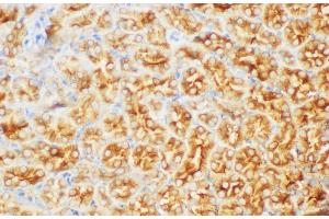 Immunohistochemistry of paraffin-embedded Mouse kidney using FGB Polycloanl Antibody at dilution of 1:200 (Fibrinogen beta Chain antibody)