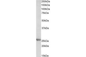 AP21517PU-N PSMB4 antibody staining of Mouse Liver lysate at 0. (PSMB4 antibody  (Internal Region))