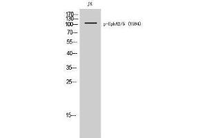 Western Blotting (WB) image for anti-EPHA2/5 (pTyr594) antibody (ABIN3180443) (EPHA2/5 (pTyr594) antibody)