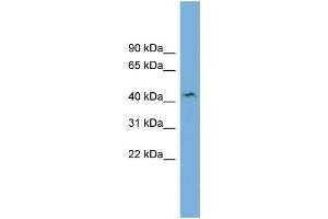 WB Suggested Anti-B4GALT3 Antibody Titration:  0.