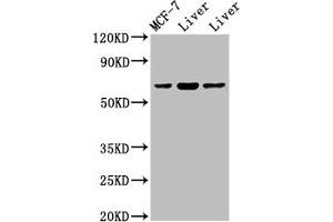 Western Blot Positive WB detected in: MCF-7 whole cell lysate, Rat liver tissue, Mouse liver issue All lanes: PTH1R antibody at 2 μg/mL Secondary Goat polyclonal to rabbit IgG at 1/50000 dilution Predicted band size: 67 kDa Observed band size: 67 kDa