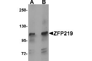 Western blot analysis of ZFP219 in mouse brain tissue lysate with ZFP219 antibody at (A) 1 and (B) 2 µg/mL. (ZNF219 antibody  (N-Term))