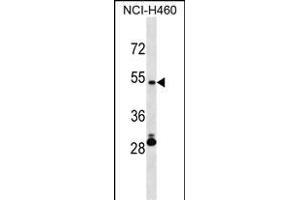 IRX6 Antibody (Center) (ABIN1538203 and ABIN2850242) western blot analysis in NCI- cell line lysates (35 μg/lane). (IRX6 antibody  (AA 260-288))