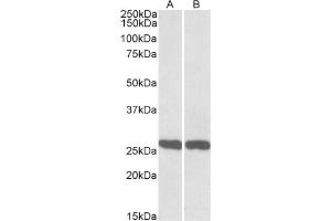 AP21292PU-N UCHL1 antibody staining of Mouse (A) and Rat (B) Brain lysate at 0.
