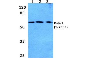 Western blot (WB) analysis of p-Dok-1 antibody at 1/500 dilution (DOK1 antibody  (pTyr362))