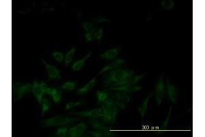 Immunofluorescence of monoclonal antibody to SERPINB5 on HeLa cell. (SERPINB5 antibody  (AA 1-231))