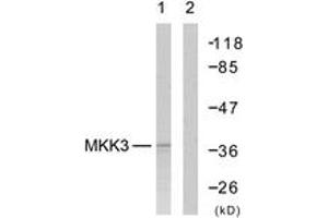 Western blot analysis of extracts from MDA-MB-435 cells, using MKK6 (Ab-207) Antibody.