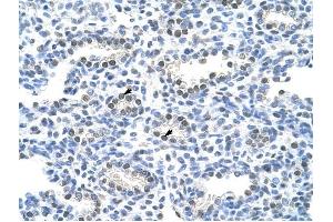 PAIP1 antibody was used for immunohistochemistry at a concentration of 4-8 ug/ml to stain Alveolar cells (arrows) in Human Lung. (PAIP1 antibody)