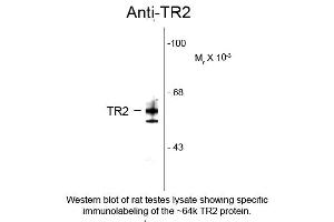 Western blot of Anti-Testicular Receptor 2 (TR2) (Rabbit) Antibody - 100-401-E45 Western Blot of Rabbit Anti-Testicular Receptor 2 (TR2) Antibody. (NR2C1 antibody  (N-Term))