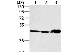 Western Blot analysis of Mouse liver tissue and PC3 cell, Human fetal liver tissue using SEC14L2 Polyclonal Antibody at dilution of 1:400 (SEC14L2 antibody)