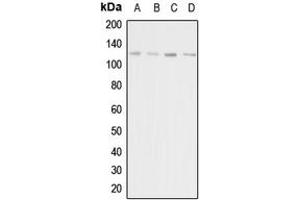 Western blot analysis of Adenylate Cyclase 1 expression in HeLa (A), HEK293T (B), mouse liver (C), rat kidney (D) whole cell lysates. (ADCY1 antibody  (Center))