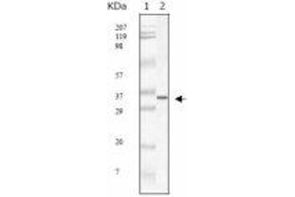 SARS-Coronavirus Membrane Protein (SARS-CoV M) antibody