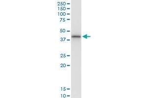 Immunoprecipitation of SNUPN transfected lysate using anti-SNUPN MaxPab rabbit polyclonal antibody and Protein A Magnetic Bead , and immunoblotted with SNUPN MaxPab mouse polyclonal antibody (B01) . (Snurportin 1 antibody  (AA 1-360))