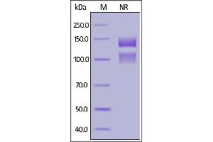 Human ITGA5&ITGB1 Heterodimer Protein, His Tag&Tag Free on  under ing (NR) condition.