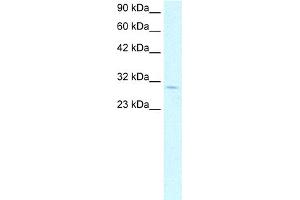 WB Suggested Anti-CDK4 Antibody Titration: 1. (CDK4 antibody  (C-Term))