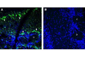 Expression of BMPR1A in mouse olfactory bulb.