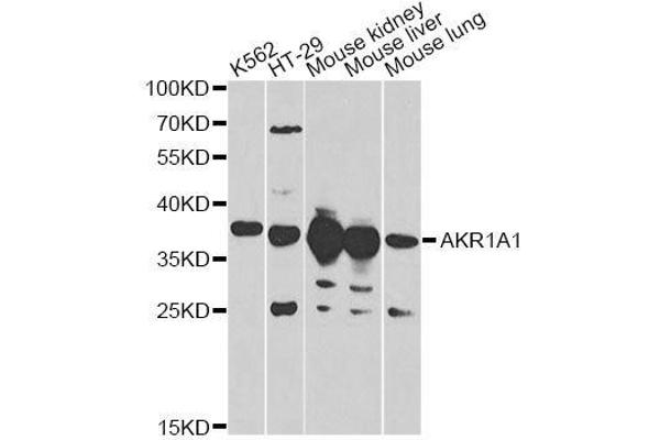 AKR1A1 anticorps  (AA 1-325)
