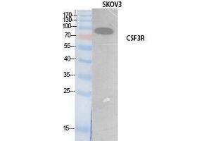Western Blotting (WB) image for anti-Colony Stimulating Factor 3 Receptor (Granulocyte) (CSF3R) (Internal Region) antibody (ABIN3181067) (CSF3R antibody  (Internal Region))