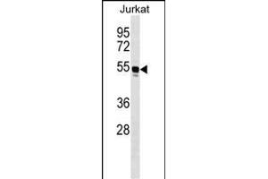 WARS Antibody (C-term) (ABIN1536896 and ABIN2849624) western blot analysis in Jurkat cell line lysates (35 μg/lane). (WARS antibody  (C-Term))
