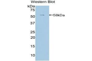 Detection of Recombinant LAMb3, Human using Polyclonal Antibody to Laminin Beta 3 (LAMb3) (Laminin beta 3 antibody  (AA 352-587))