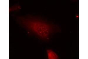 Immunofluorescence staining of methanol-fixed Hela cells using FKHR(Phospho-Ser319) Antibody. (FOXO1 antibody  (pSer319))