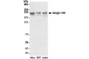 anti-Golgin A3 (GOLGA3) (AA 1-50) antibody