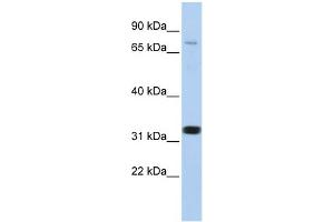 WB Suggested Anti-CACNB2 Antibody Titration:  0. (CACNB2 antibody  (N-Term))