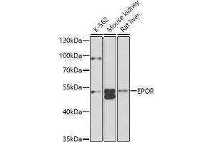 Western blot analysis of extracts of various cell lines, using EPOR antibody (ABIN3016975, ABIN3016976, ABIN1679740, ABIN1679741 and ABIN6219913) at 1:1000 dilution. (EPOR antibody  (AA 274-508))
