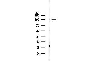 anti-General Transcription Factor IIIC, Polypeptide 3, 102kDa (GTF3C3) (N-Term) antibody