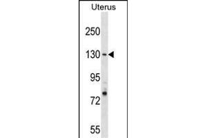 RFC1 Antibody (N-term) (ABIN1539238 and ABIN2838143) western blot analysis in Uterus tissue lysates (35 μg/lane). (RFC1 antibody  (N-Term))