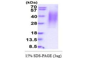 SDS-PAGE (SDS) image for CD164 (CD164) (AA 24-162) protein (His tag) (ABIN5855048) (CD164 Protein (CD164) (AA 24-162) (His tag))