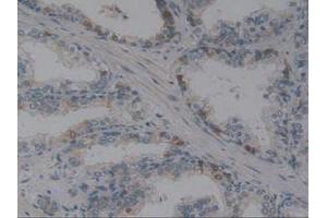 IHC-P analysis of Human Prostate Gland Tissue, with DAB staining. (Angiotensin I Converting Enzyme 1 antibody  (AA 1160-1306))
