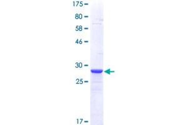 METRN Protein (AA 118-178) (GST tag)
