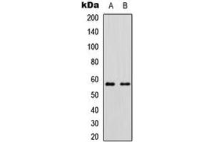Western blot analysis of Cytochrome P450 11B2 expression in HEK293T (A), Raw264. (Cytochrome P450 11B2 (Center) antibody)