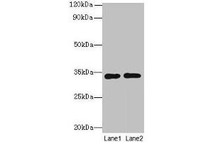 Western blot All lanes: Rgn antibody at 8 μg/mL Lane 1: A549 whole cell lysate Lane 2: HCT116 whole cell lysate Secondary Goat polyclonal to rabbit IgG at 1/10000 dilution Predicted band size: 34 kDa Observed band size: 34 kDa (Regucalcin antibody  (AA 1-299))