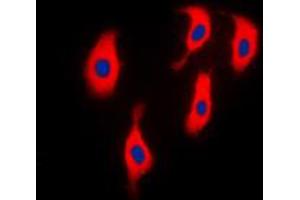 Immunofluorescent analysis of ACTN2 staining in H9C2 cells.