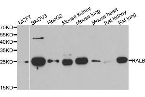 Western blot analysis of extracts of various cell lines, using RALB antibody. (RALB antibody)