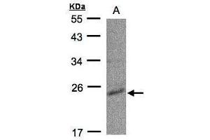 WB Image Sample(30 ug whole cell lysate) A:Raji , 12% SDS PAGE antibody diluted at 1:500 (Cytidine Monophosphate (UMP-CMP) Kinase 1, Cytosolic (CMPK1) (Center) antibody)