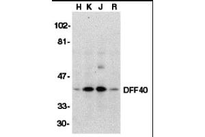 Western Blotting (WB) image for anti-DNA Fragmentation Factor, 40kDa, beta Polypeptide (Caspase-Activated DNase) (DFFB) (Middle Region) antibody (ABIN1030918)