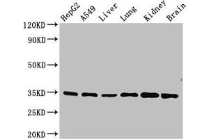 Western Blot Positive WB detected in: HepG2 whole cell lysate, A549 whole cell lysate, Mouse liver tissue, Mouse lung tissue, Mouse kidney tissue, Mouse brain tissue All lanes: GFRA2 antibody at 3. (GFRA2 antibody  (AA 242-415))