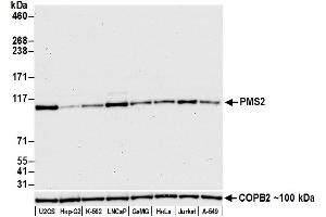 Western Blotting (WB) image for anti-PMS2 Postmeiotic Segregation Increased 2 (S. Cerevisiae) (PMS2) (AA 550-600) antibody (ABIN7453299)