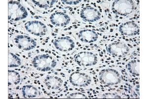 Immunohistochemical staining of paraffin-embedded colon tissue using anti-BRAFmouse monoclonal antibody. (BRAF antibody)