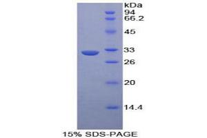 SDS-PAGE analysis of Human EPHA1 Protein. (EPHA1 Protein)